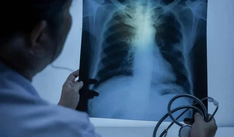 Zatürre Tehdidi: Aşı ve Erken Tanı Hayat Kurtarıyor